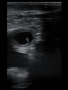 202511051247060001SMP